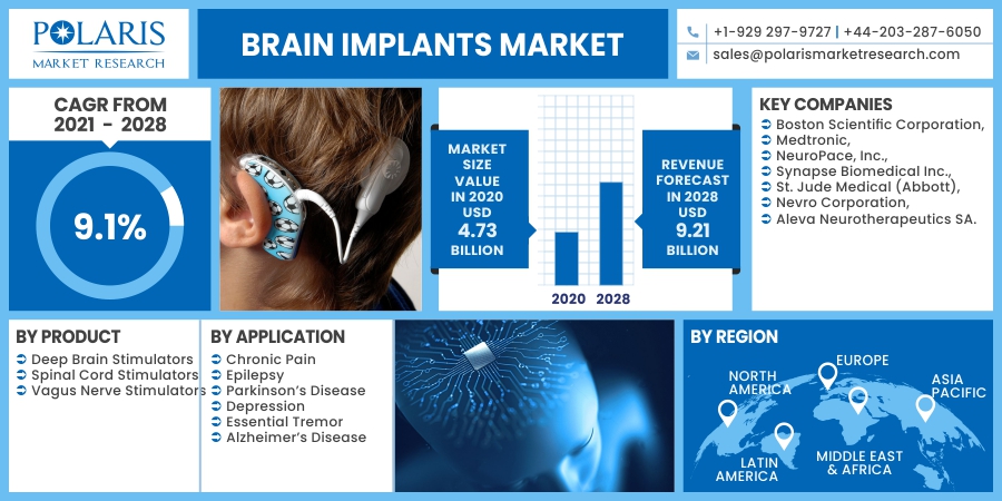 Brain_Implants_Market24