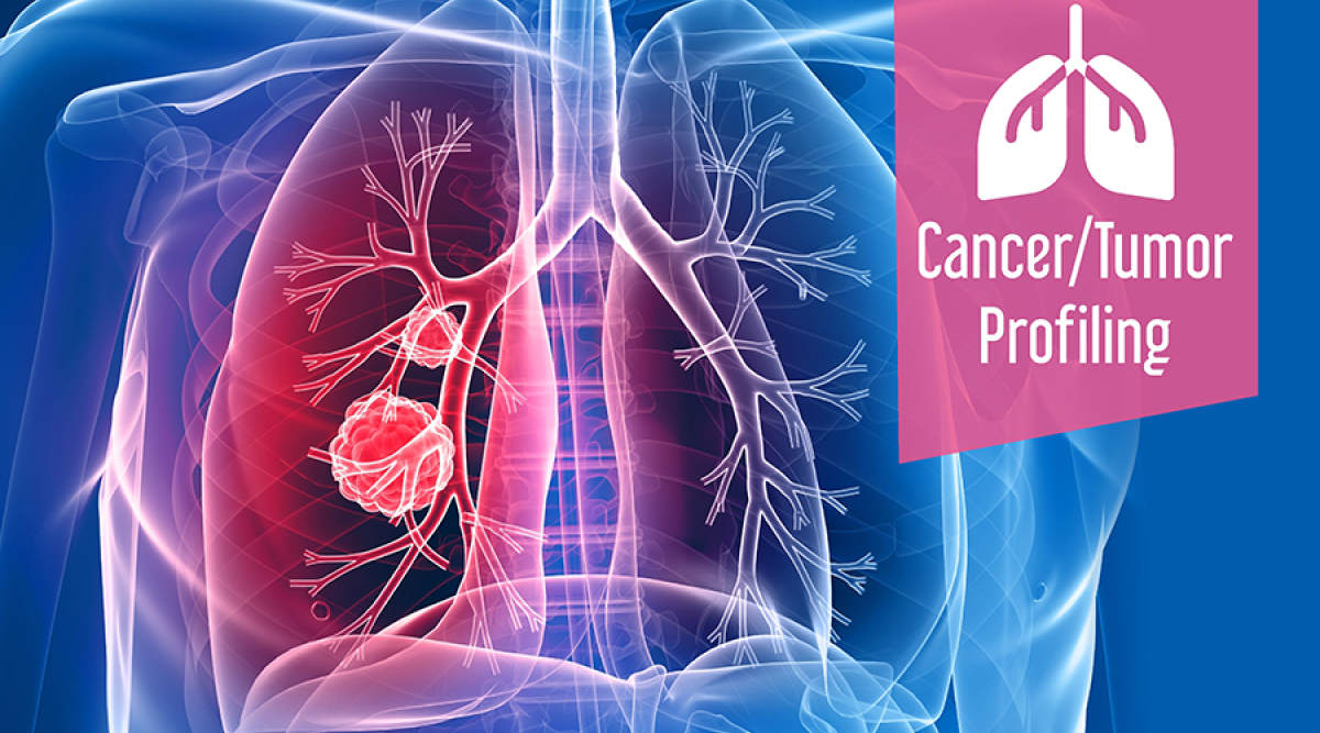 Cancer_Tumor_Profiling_Market