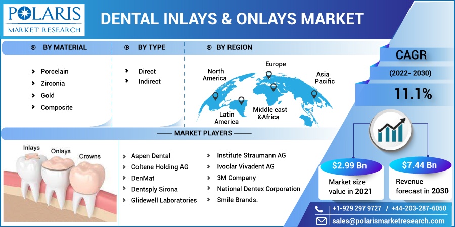 Dental_Inlays_Onlays_Market9