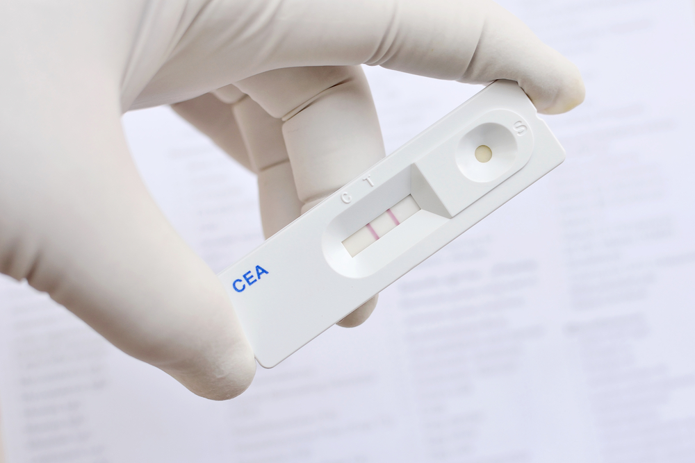 Malaria_Rapid_Diagnostic_Tests_(RDTs)_Market