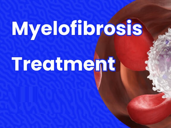 Myelofibrosis_Treatment