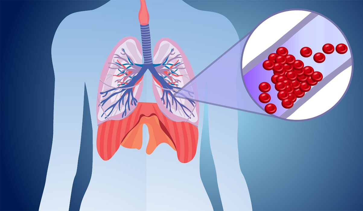 Pulmonary_Dilation_Balloon