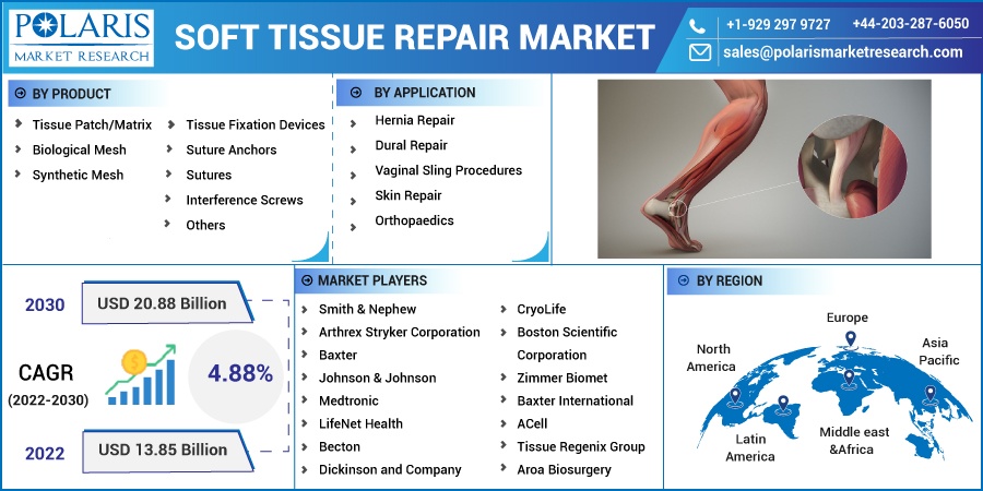 Soft-Tissue-Repair-Market1