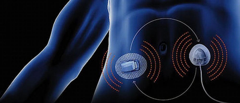 Artificial_Pancreas_Devices_Systems_Market