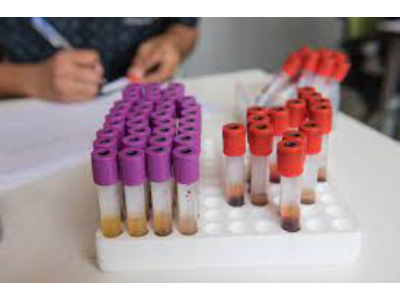 Creatinine_Test_Market