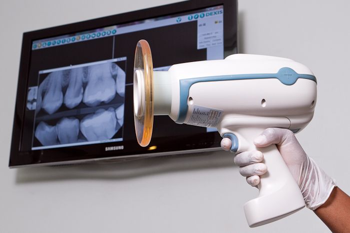 Dental_X-Ray_Machines