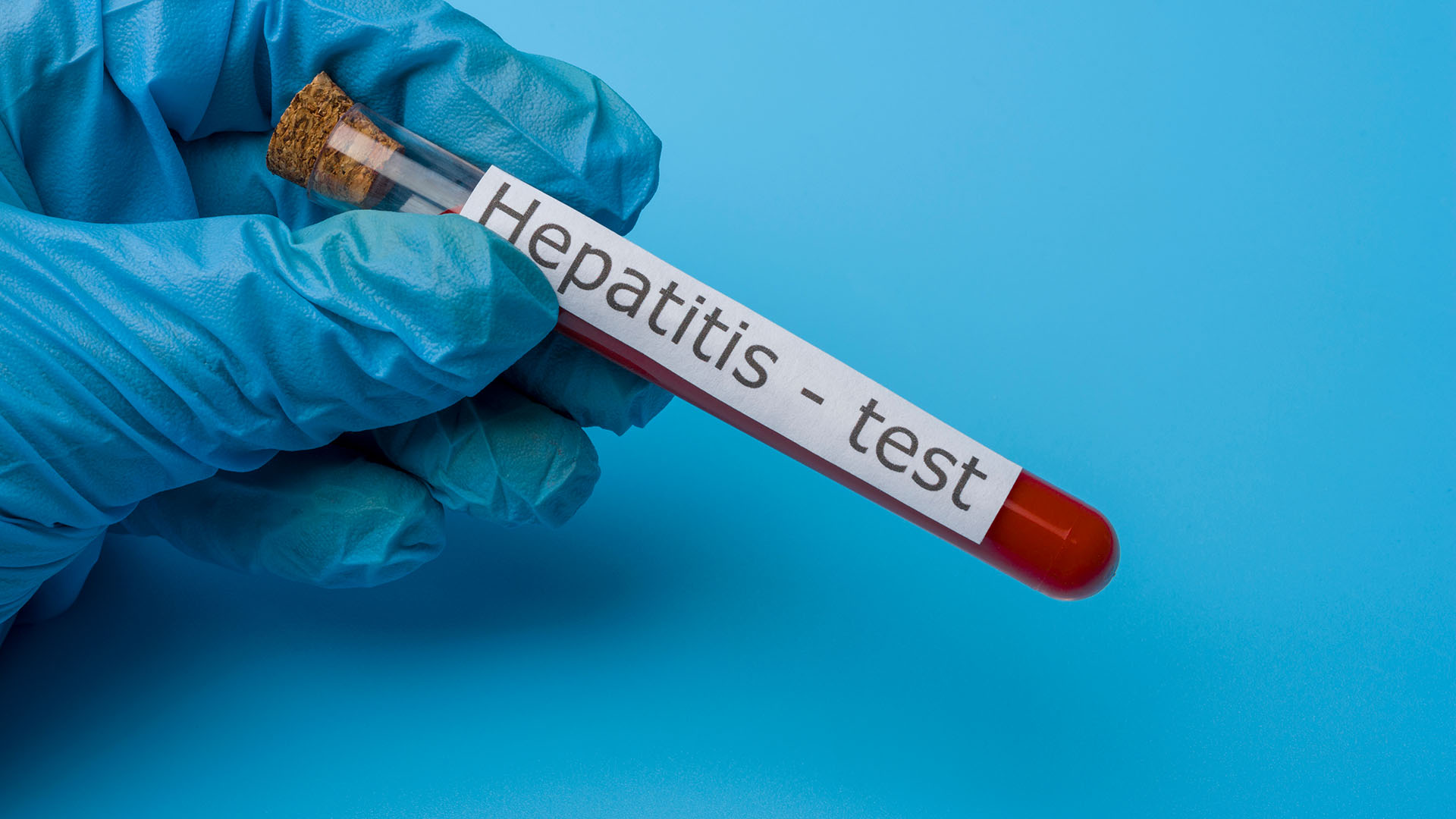 Hepatitis_Testing