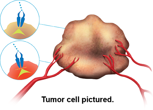 Lenvatinib_Market