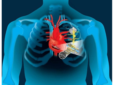 Structural_Heart_Devices_Market